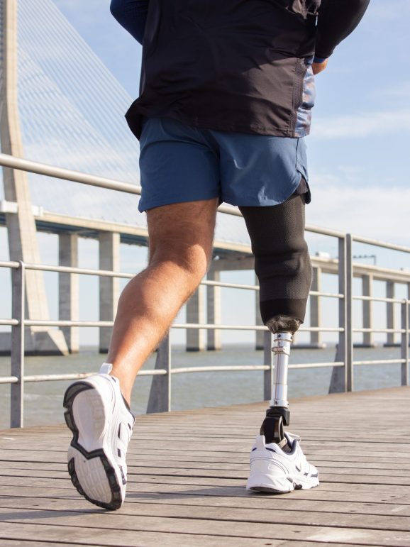 Close-up of man with mechanical leg running. Sportsman in blue shorts and white sneakers photographed during jog. Sport, hobby, disability concept