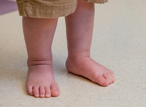 Example-of-pronation