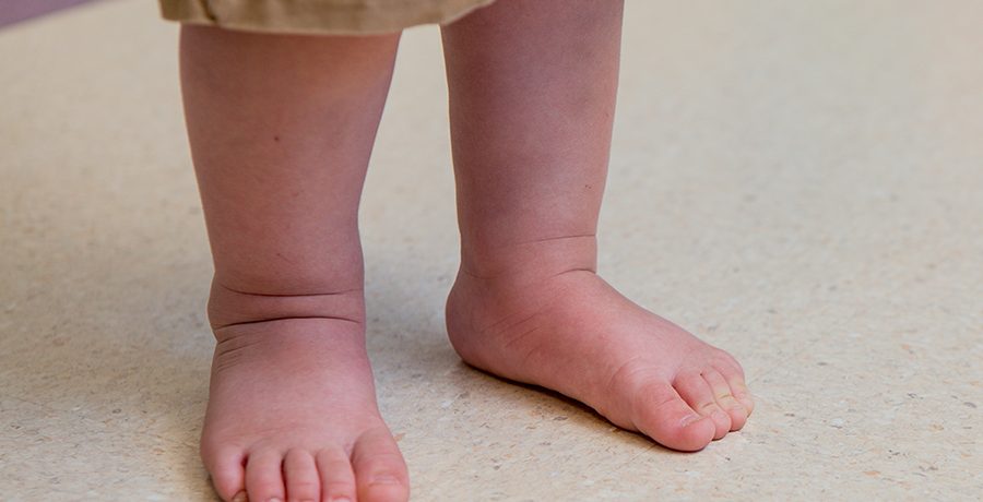 Example-of-pronation