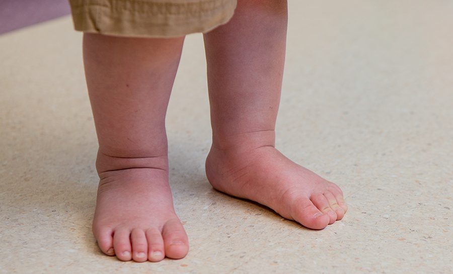Example-of-pronation Example-of-pronation